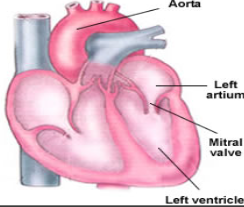 <p>Where is the bicuspid / mitral valve located? </p>