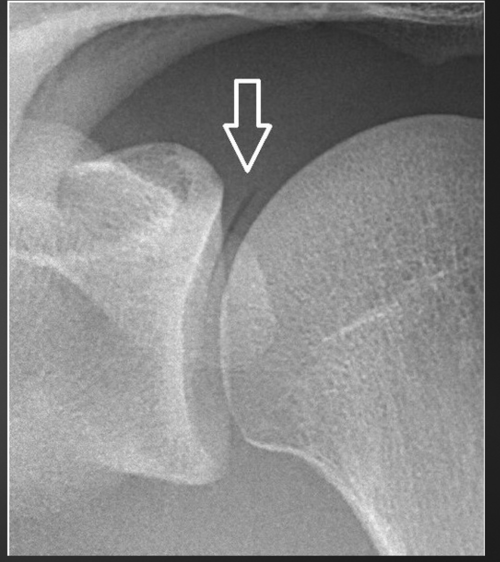 <p>what is this anomaly called </p>