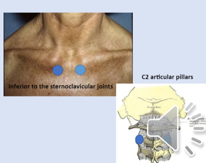 <p>anterior point: inferior to sternoclavicular joints<br>posterior point: C2 articular pillars</p>