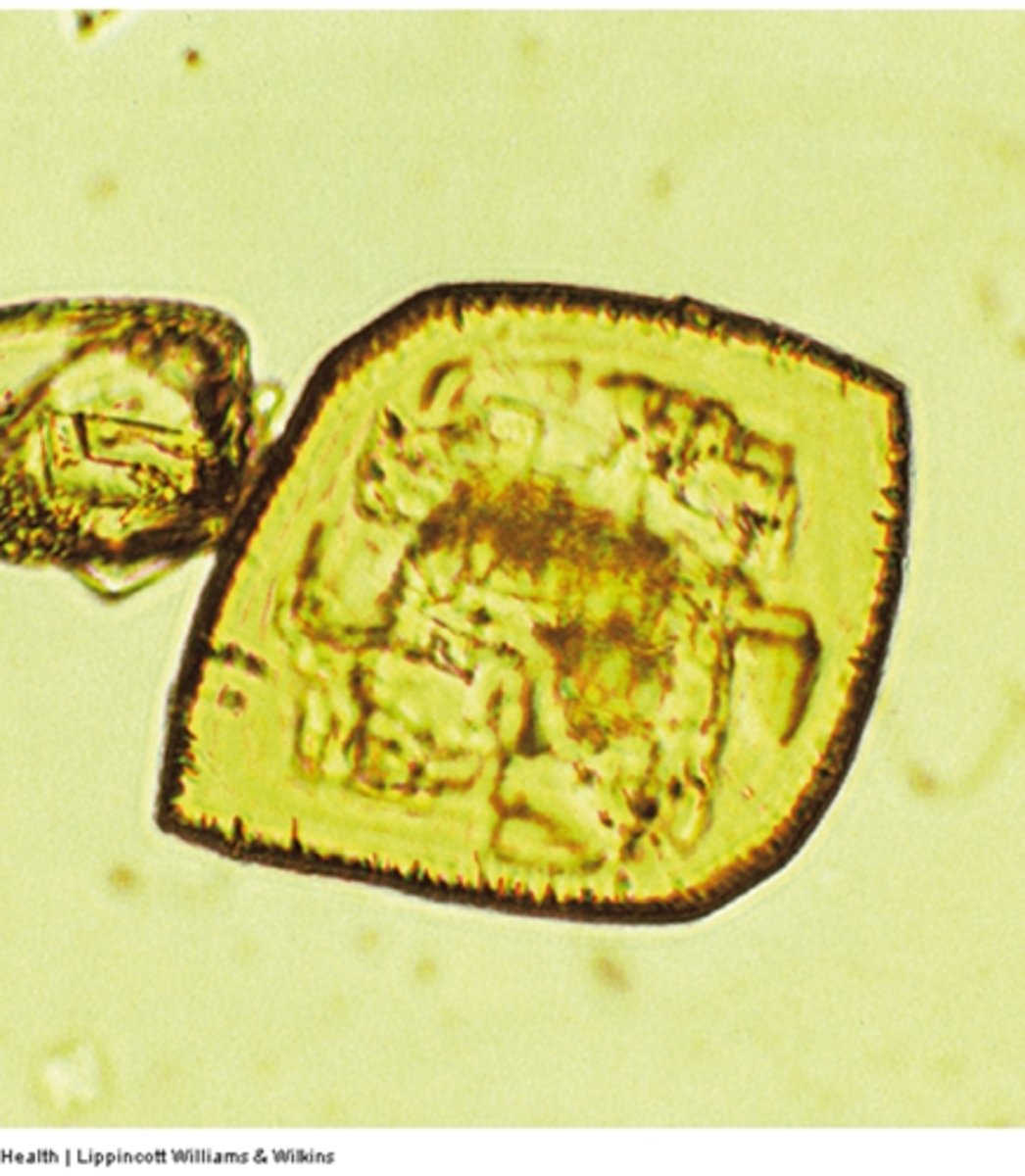 <p>What disease may be associated with this crystal, if levels are also increased in the serum?</p>