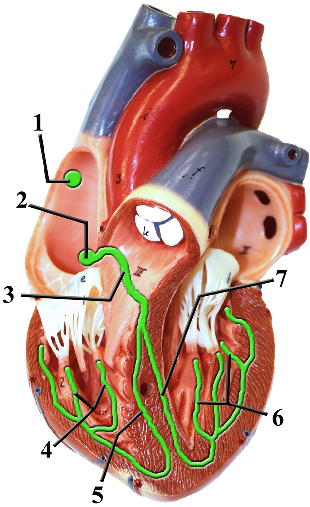 <p>Atrioventricular (AV) Bundle</p>