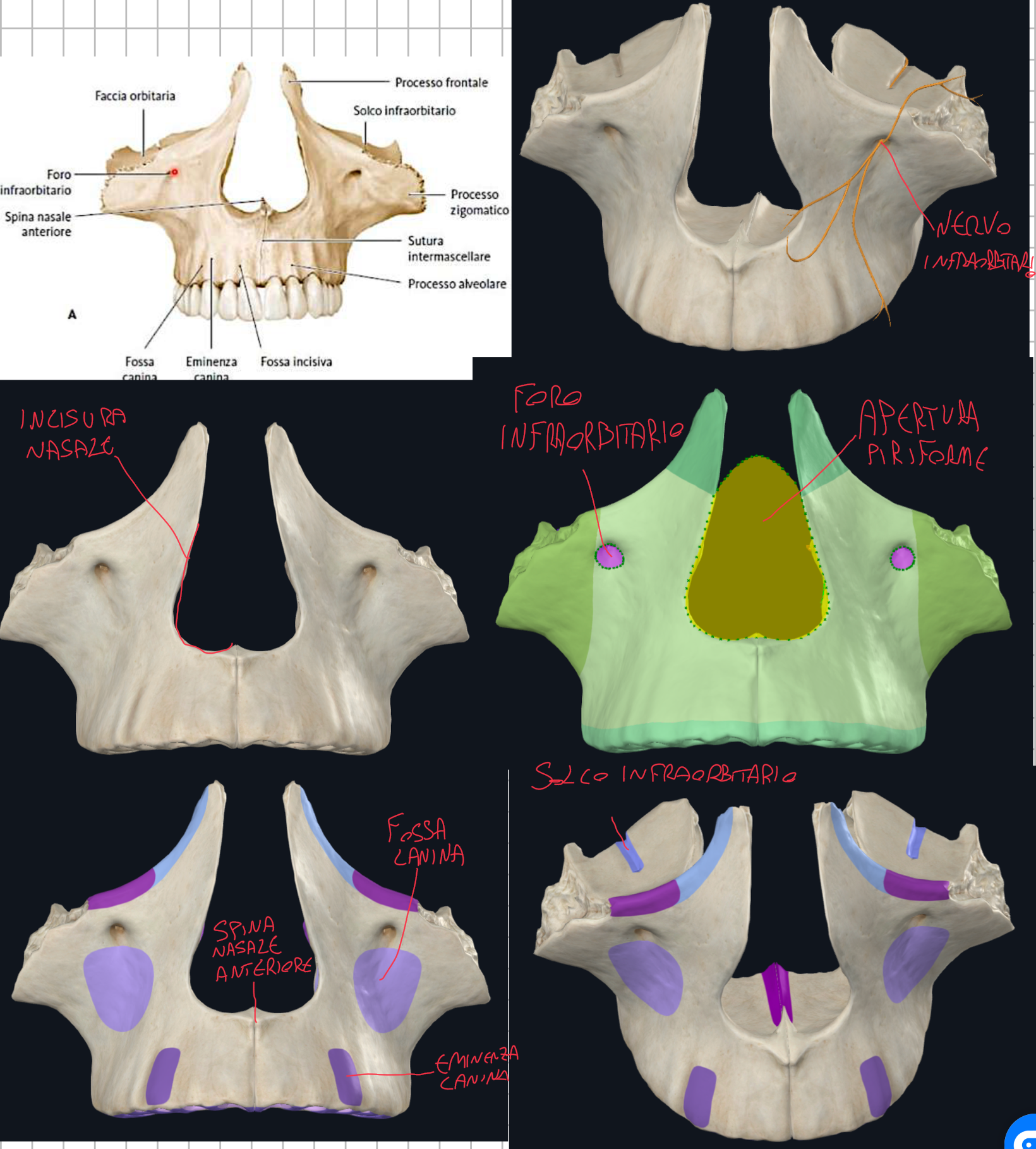 <p>Foro Infraorbitario → apertura del canale infraorbitario:</p><ul><li><p>Posteriormente inizia come solco infraorbitario sulla faccia orbitaria del mascellare</p></li><li><p>In questo canale decorre il Nervo Infraorbitario (ramo del mascellare V2) con vasi omonimi</p></li><li><p>All’uscita del foro innerva → cute palpebra inferiore, guancia, labbro superiore e ali del naso</p></li></ul><p>Eminenza Canina → rilievo prodotto dalla radice del dente canino superiore</p><p>Fossa Canina → depressione subito sotto il foro infraorbitario</p><p>Fossa Incisiva → piccola depressione in corrispondenza degli incisivi</p><p>Incisura Nasale → margine mediale della superficie anteriore che con la parte controlaterale forma l’apertura piriforme, che costituisce l’apertura anteriore della cavità nasale</p><p>Spina Nasale Anteriore → piccolo rilievo osseo che sporge all’apertura piriforme</p><p></p>