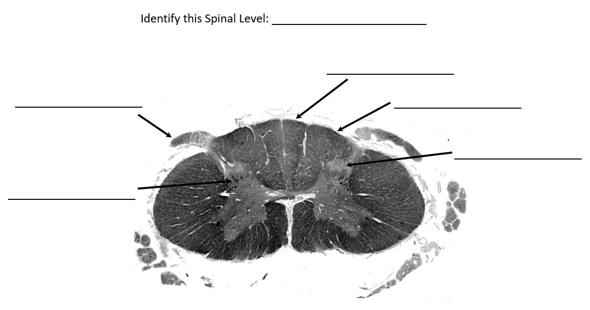 <p>identify this spinal level</p>