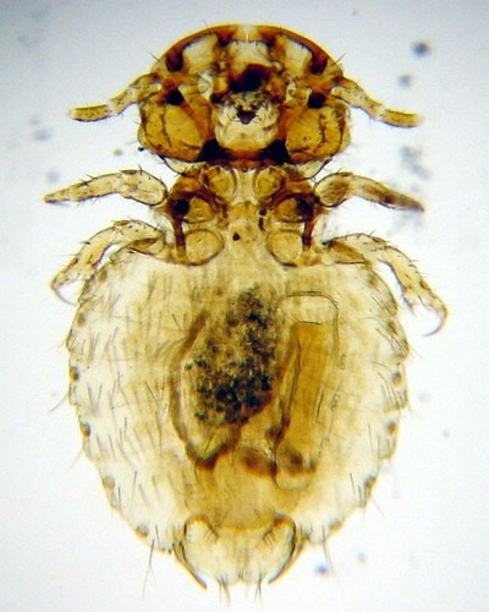 <p>bristly body, toothed mandibles, small compound eyes, head wider than thorax</p>