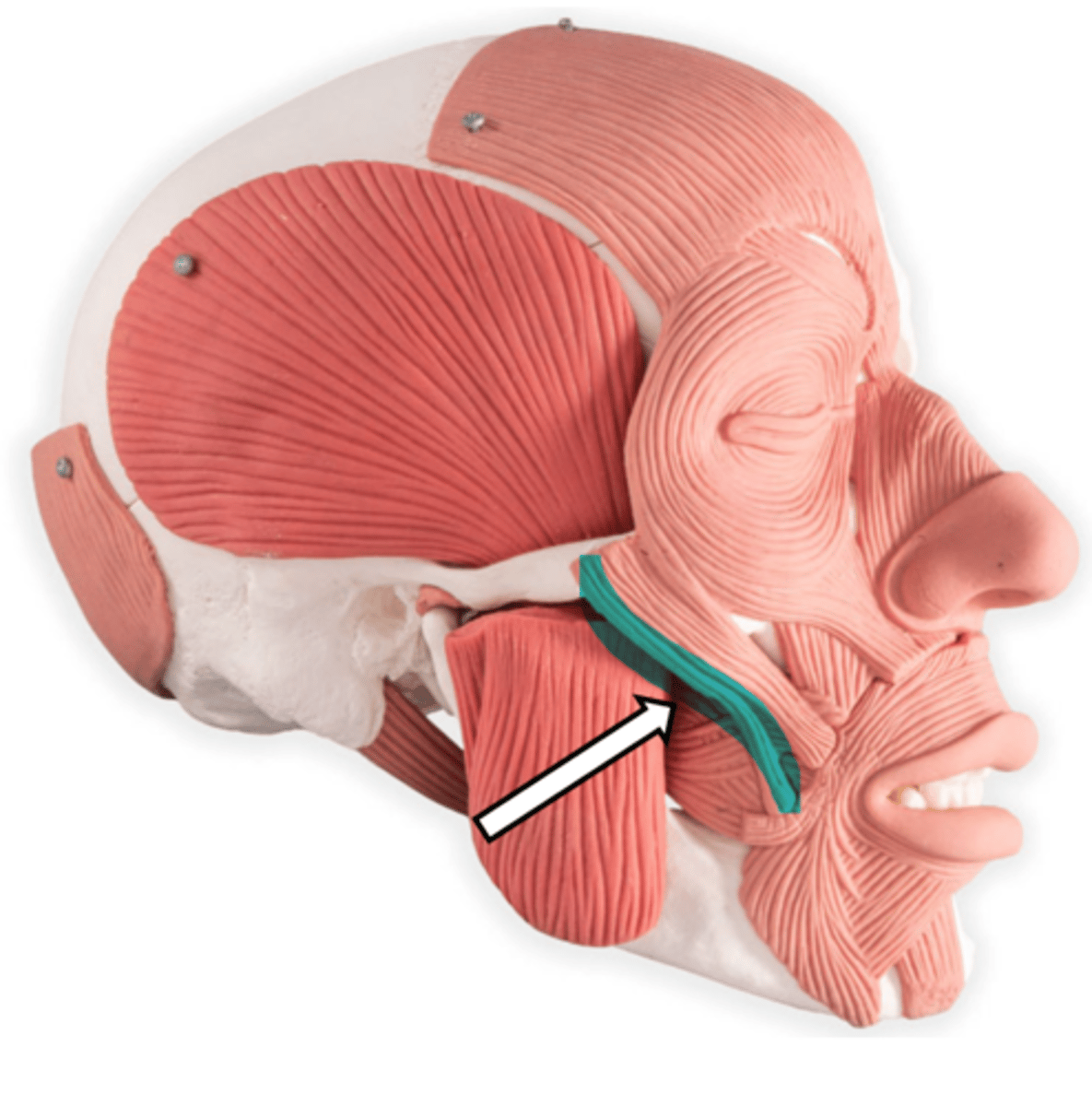 <p>name the muscle</p>