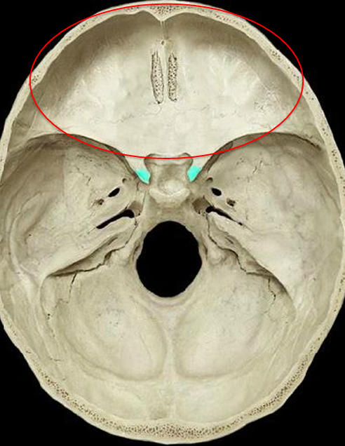 <p>middle cranial fossa, anterior cranial fossa, or posterior cranial fossa</p>