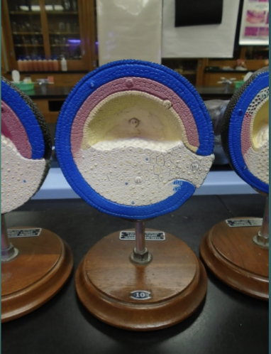 <p>explain the state of the blastula in terms of the last stage of the gastrulation process (according to this model). </p>