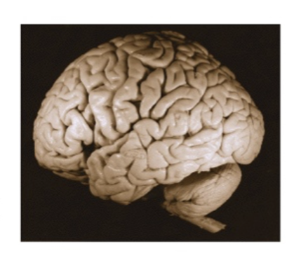 <p>What view of the brain is this </p>