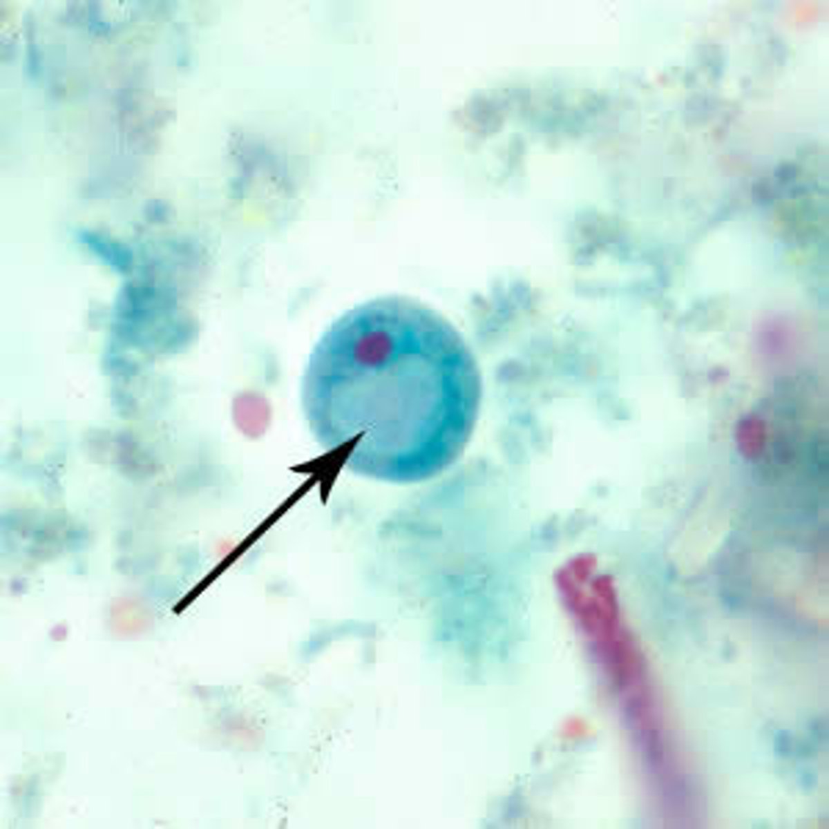 <p>large vacuole</p>