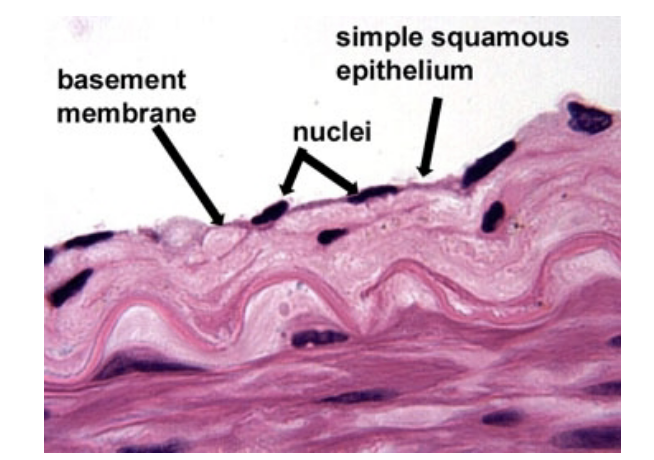 <p>simple squamous epithelium </p>
