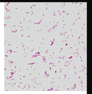 <ul><li><p>slender rods or cocobacilli</p></li><li><p>Prevotella and Porphyromonas were previously classified as Bacteroides</p></li><li><p>infection cause by injury of the colon (peritonitis)</p></li><li><p>ID: grow in laked blood agar KV</p><ul><li><p>colonial characteristic</p></li><li><p>short chain fatty acid by LGC</p></li><li><p>biochemical features </p></li></ul></li></ul><p></p>