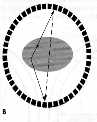 <p>This is an example of _____ coincidence</p>