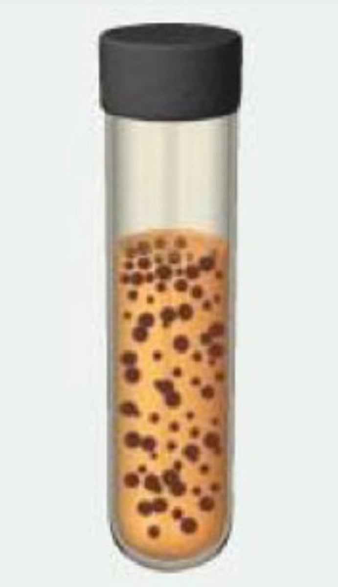 <p>name what kind of microbe in the test tube and describe the growth pattern</p>