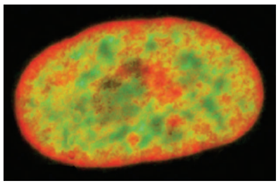<p>Heterochromatic regions are found in the nuclear lamina (towards the exterior) whereas euchromatic regions are usually more in the interior.</p>