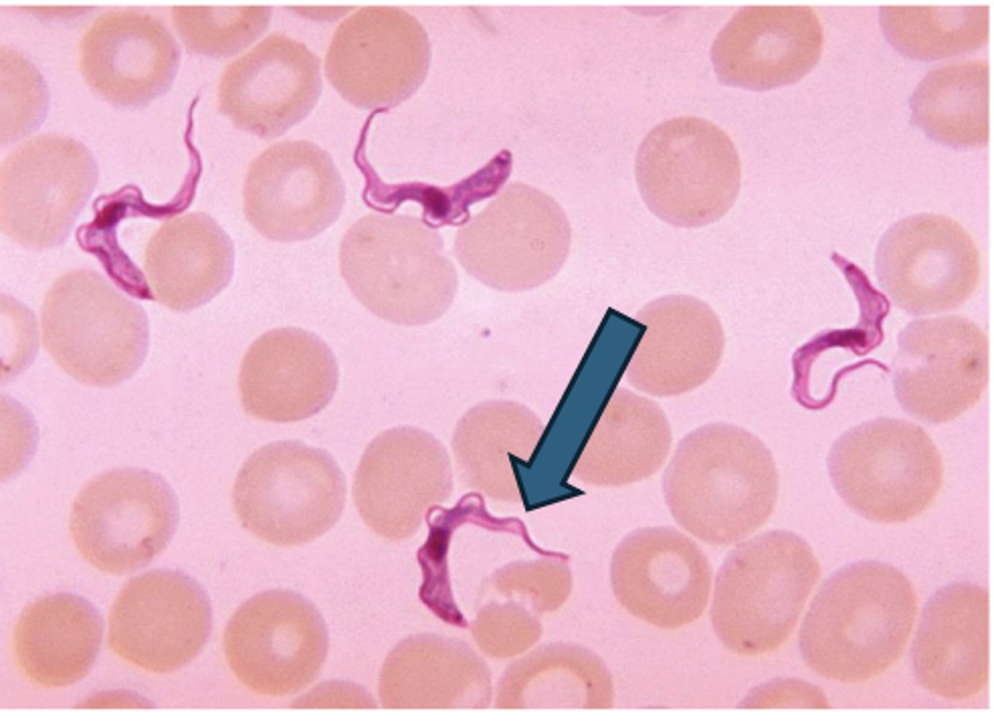 <p>Trypanosoma</p>