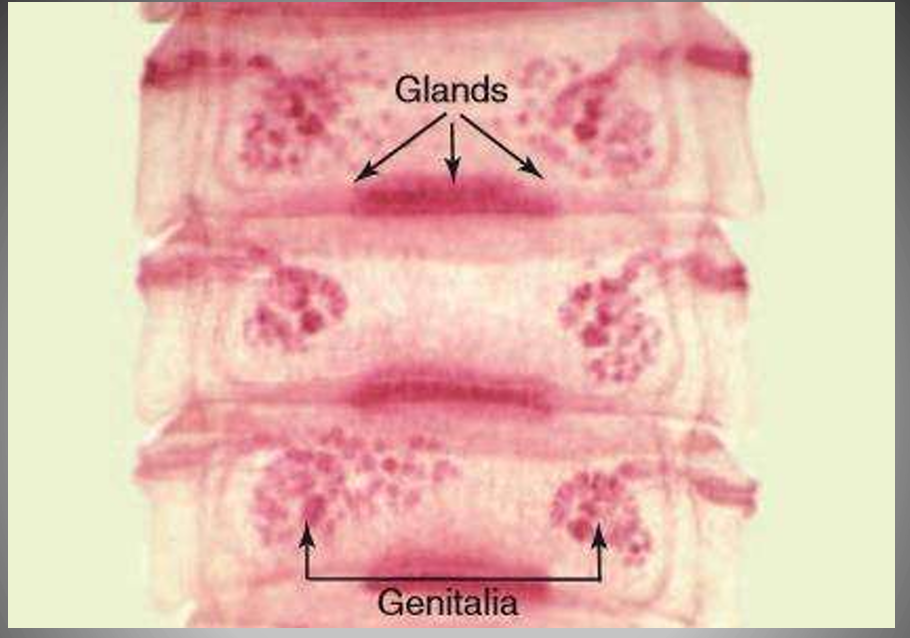 <p>Moniezia expansa</p>