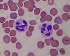 <p>fine/small amount of granules. multilobed nucleus. acts as phagocytes (consume) at active infection sites</p>