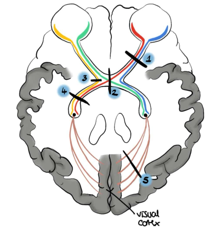 term image