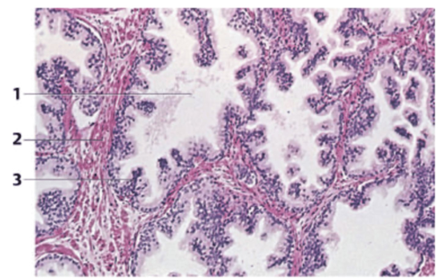 <p>A 62-year-old man presents with urinary hesitancy, weak stream, and incomplete emptying. The organ responsible for the symptoms in the patient was surgically removed via a transurethral approach. A biopsy from the specimen is seen in the figure. </p><p>What organ does this biopsy come from?</p>