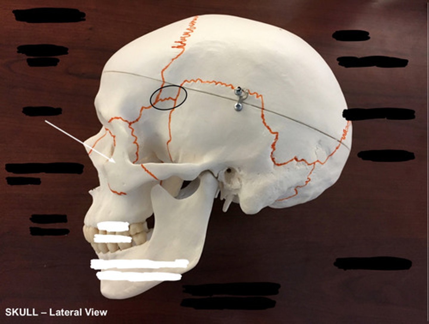 <p>What structure is circled here?</p>
