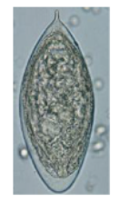 <p>What parasite egg is this?</p>