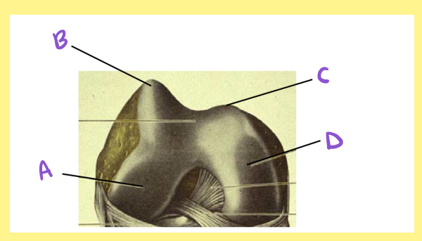 <p><u>Name the following</u>:</p><ul><li><p>Bone?</p></li><li><p>Side?</p></li><li><p>View?</p></li><li><p>B?</p></li></ul><p></p>