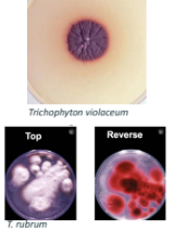 <p>Dermatofitos</p>