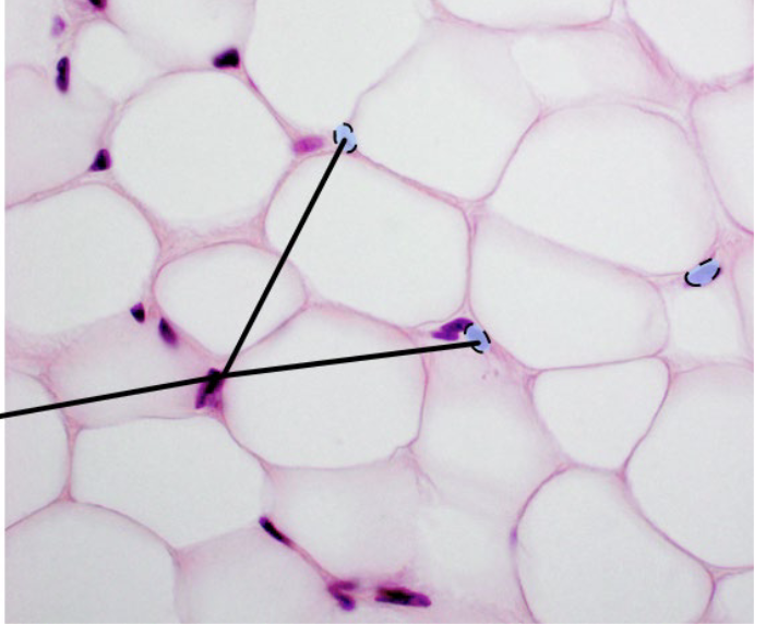 <p>What is the arrow point at?</p>
