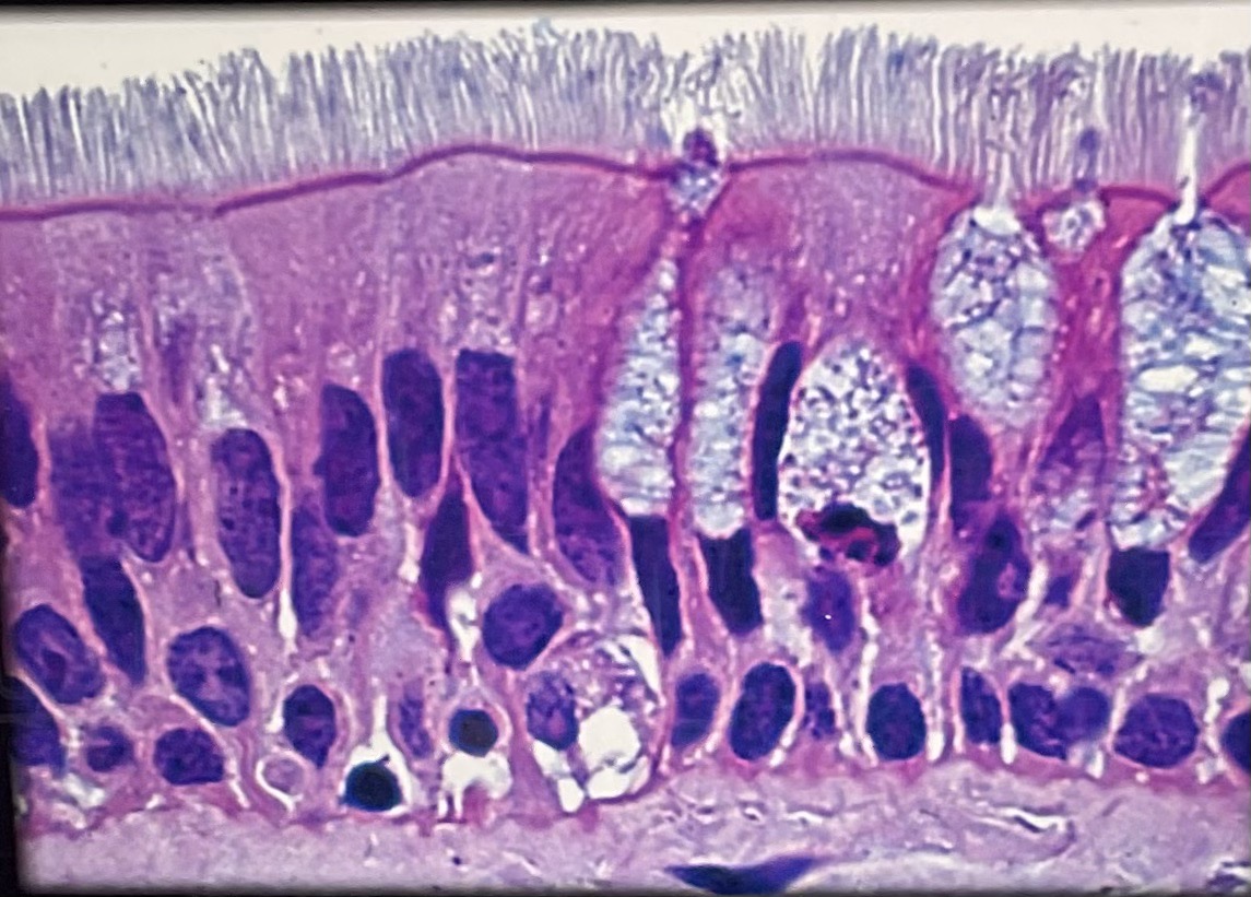 <p>What tissue type is this? Where is is located?</p>