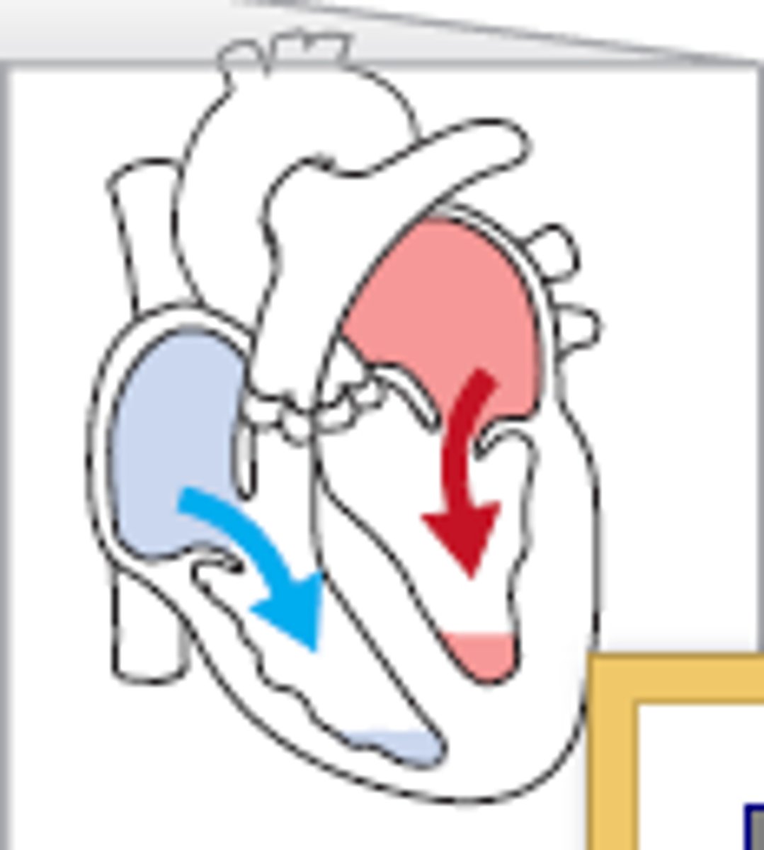 <p>Blood flows into ventricles without atrial contraction.</p>