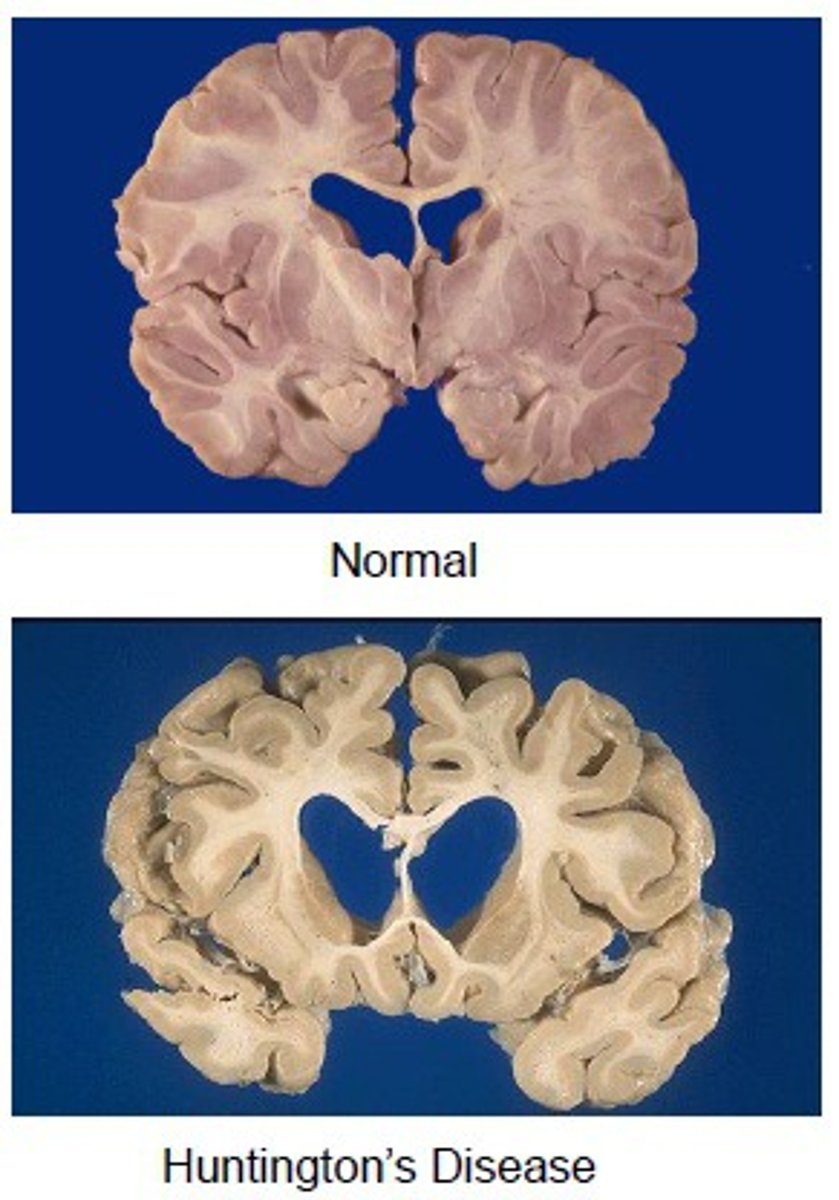 <p>Organ level</p><p>- Hypertrophy, atrophy, dysplasia</p><p>- Pigmentation, Calcification</p><p>- Fatty change</p>