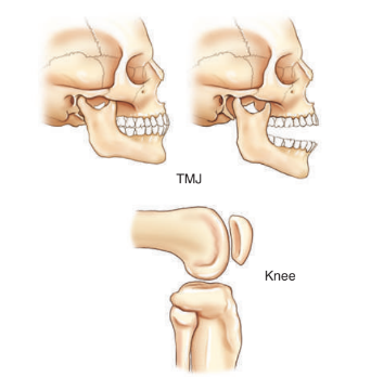 <ul><li><p>knee</p></li><li><p>temporomandibular joint</p></li></ul><p></p>