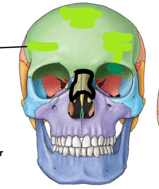 term image