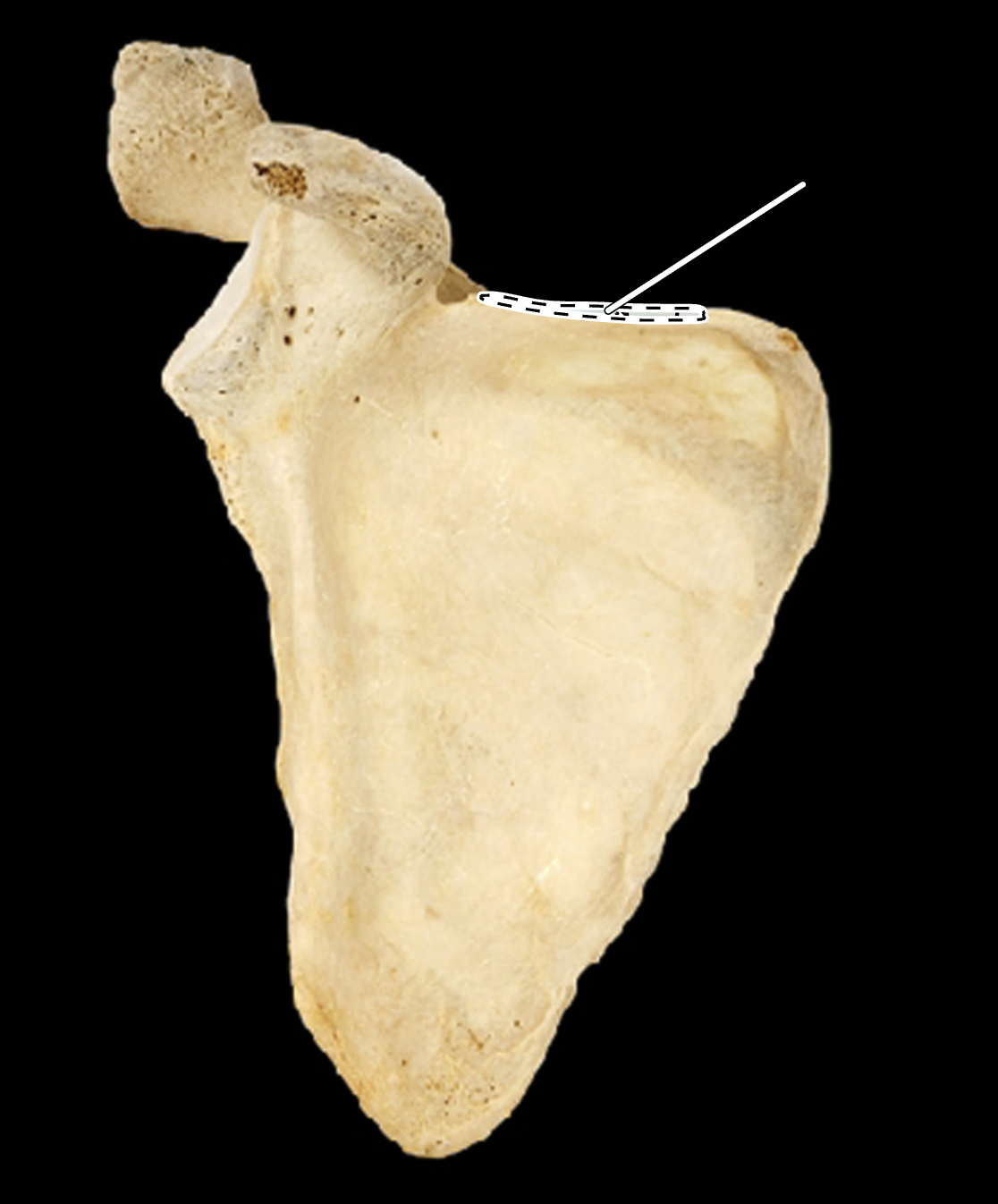 <p>name, L or R,&nbsp; A or P?</p>