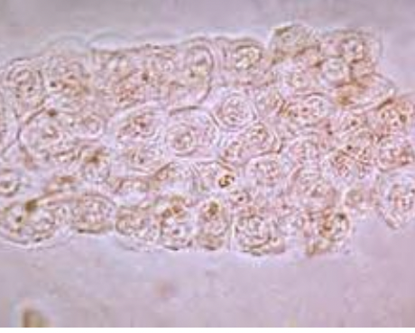 contain degenerated epithelial cells, RBCs, or WBCs (most common in animals)
