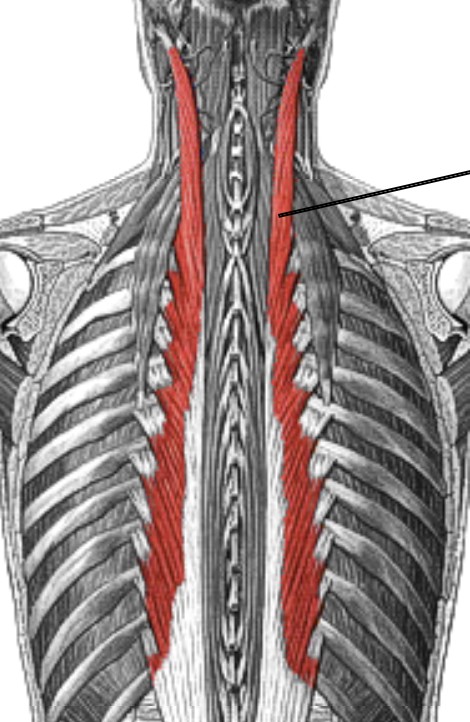 <p>Which muscle of the vertebral column is:</p><ul><li><p>Largest</p></li><li><p>Action: bi = spinal ext, uni = lat flex</p></li><li><p>Nerve: <span style="color: yellow;">posterior spinal</span> nerve roots</p></li></ul><p></p>