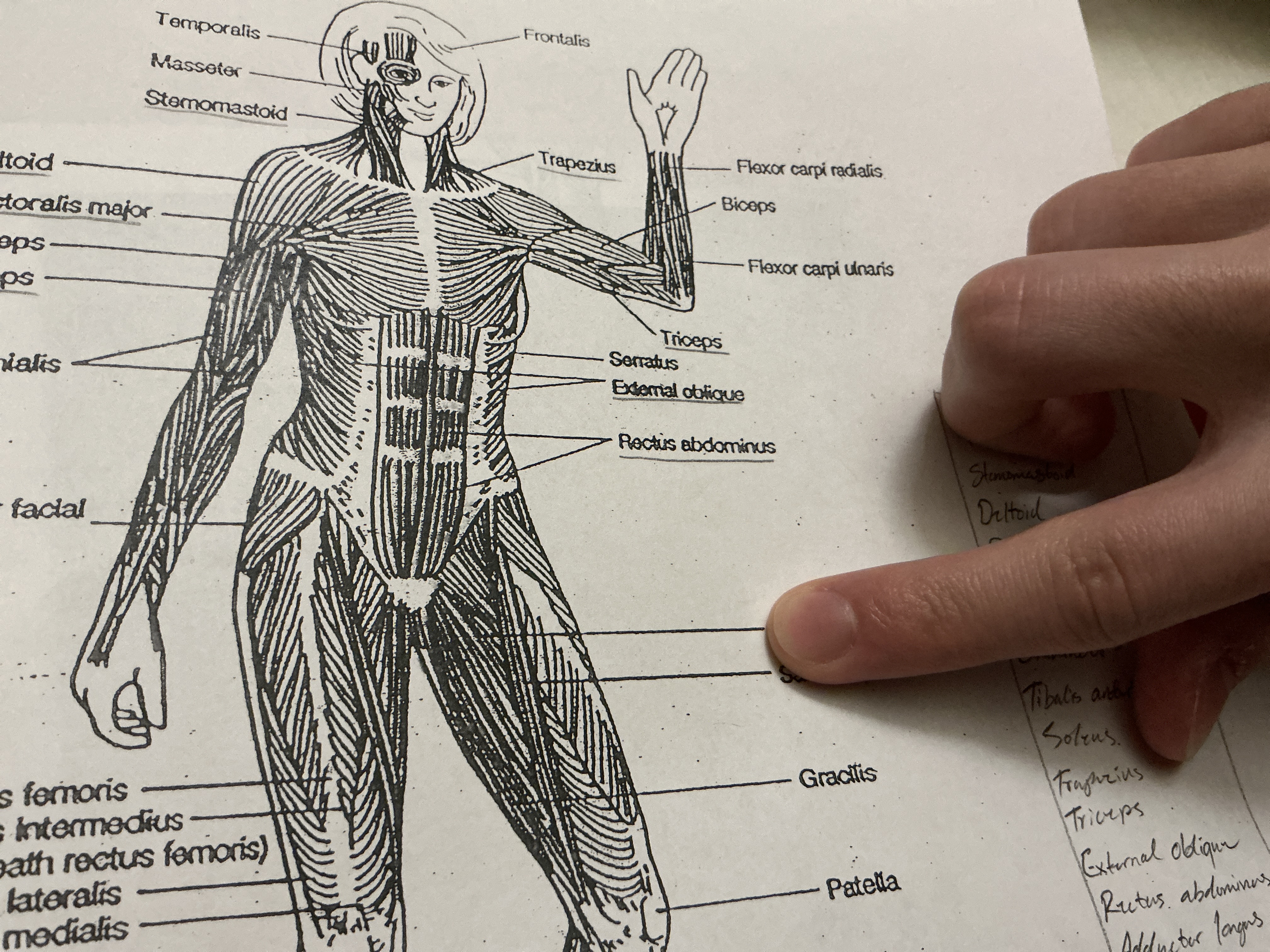 <p>a muscle in the inner thigh that helps bring the leg toward the midline of the body (adduction).</p>