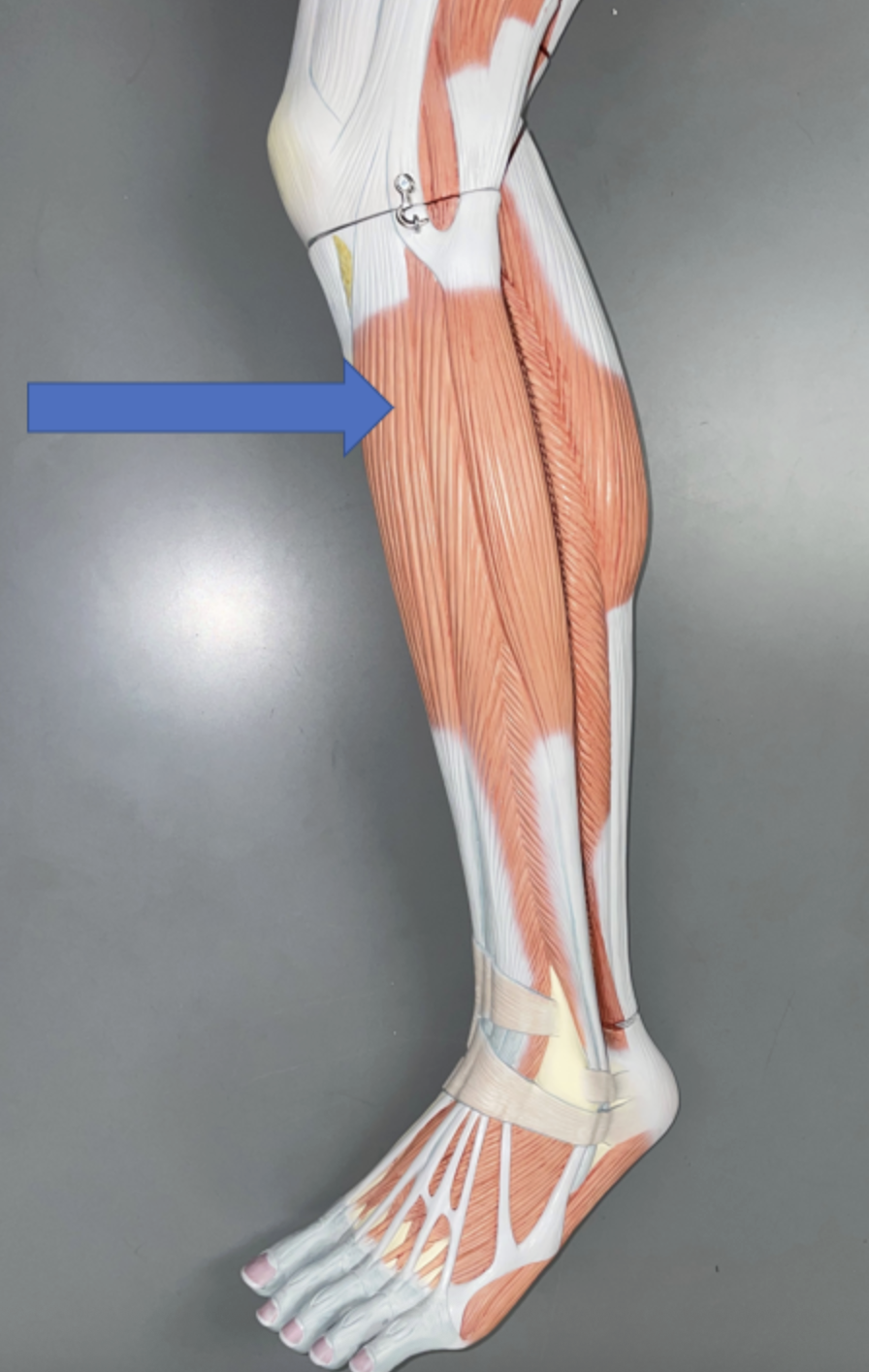 <p>muscle name &amp; action</p>