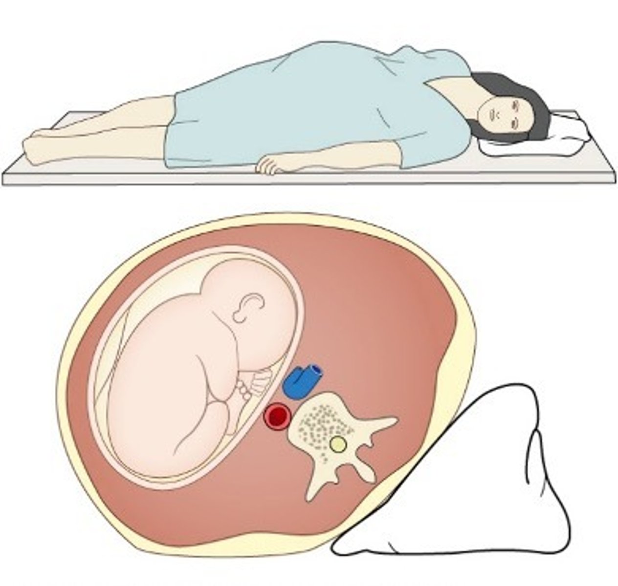 <p>On a left lateral tilt. </p>