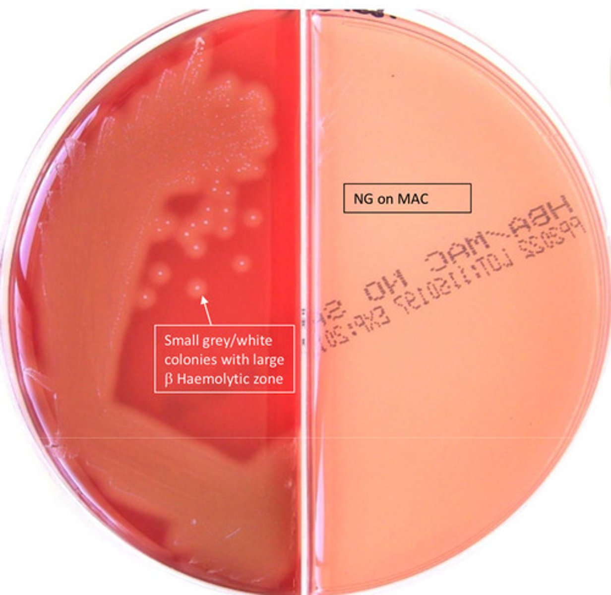 <p>GPC, catalase neg, commonly causes tonsillitis, beta haemolytic, group A antigen pos, Bacitracin sens</p>