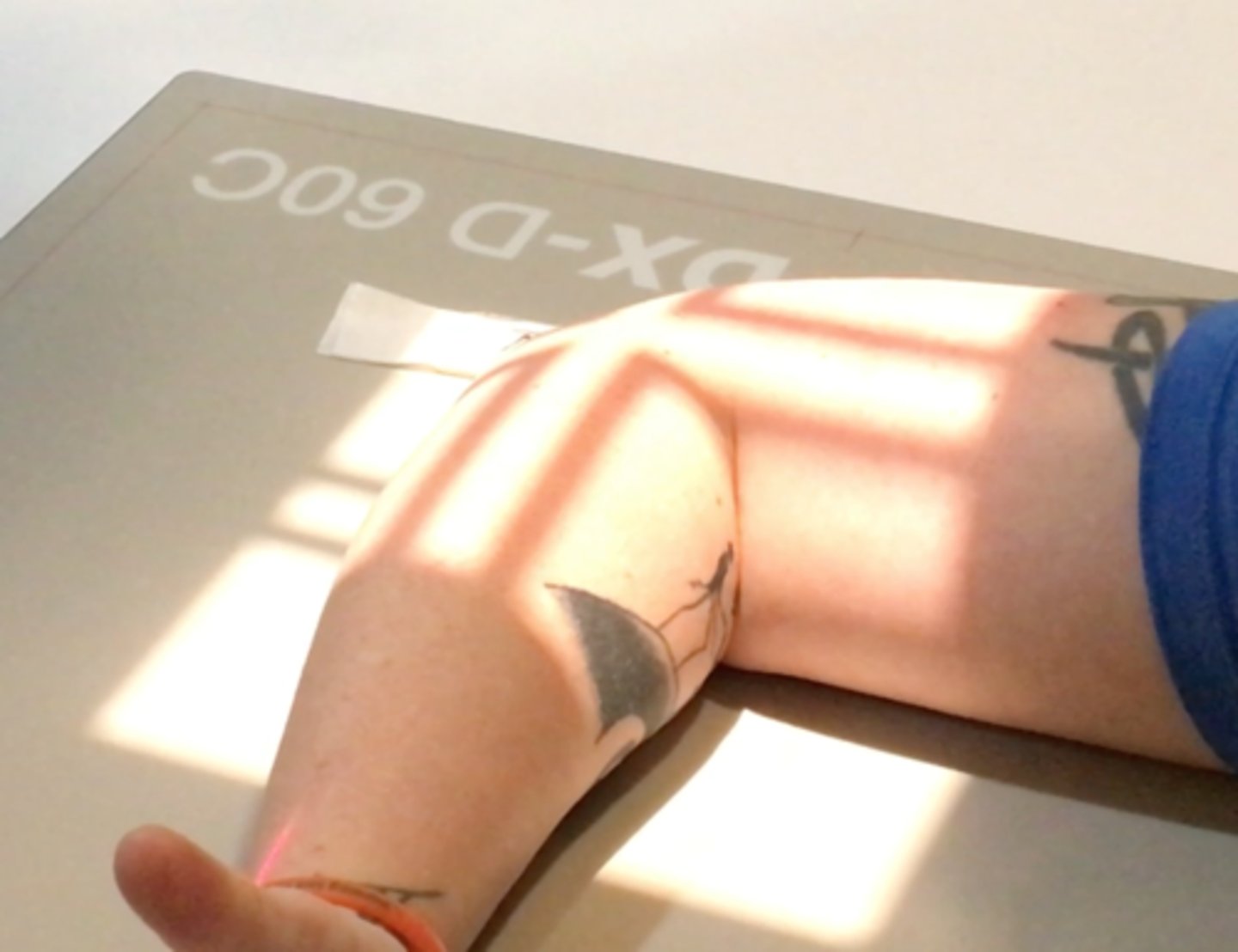 <p>Pt Placement: Lateral so wrist, elbow, and shoulder are all in the same plane, thumb up</p><p>Collimation: Part size, don't collimate too tight or you'll miss the fat pad</p><p>CR Placement: Over superimposed epicondyles</p><p>Tube tilt: none</p><p>SID: 40" tabletop</p><p>Breathing: DBDM</p>