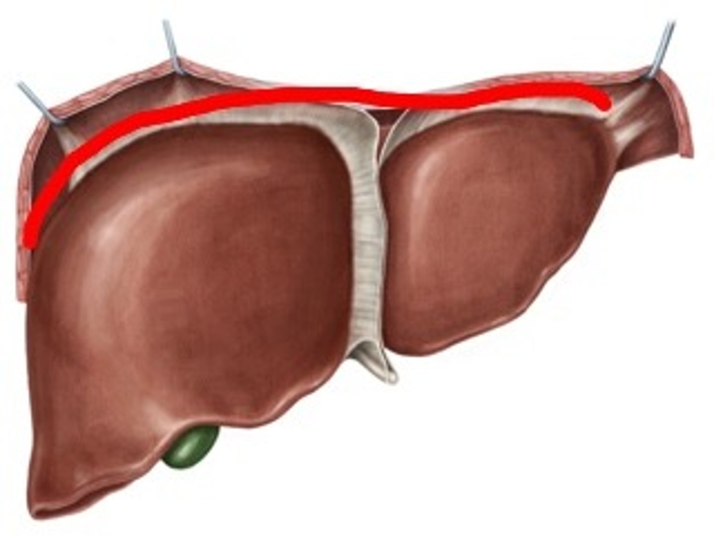 <p>Region</p><p>- On top of liver</p>