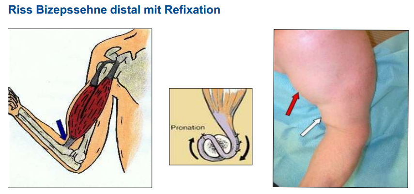 <ul><li><p>Delle unten</p></li><li><p>Kraftübertragender komplex</p></li><li><p>zu versorgen</p></li></ul><p></p>