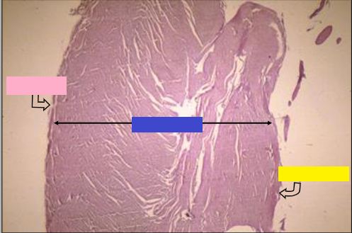 Label of Yellow rectangle