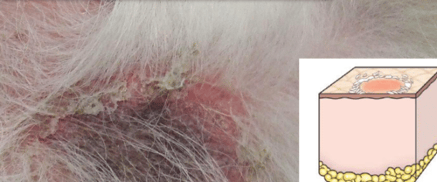 <p>What lesion is this? Is it primary or secondary?</p>