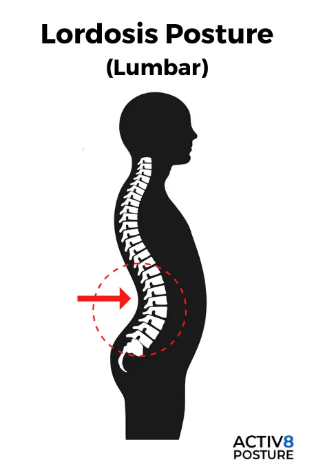 <p><span>When does lumbar lordosis develop?</span></p>