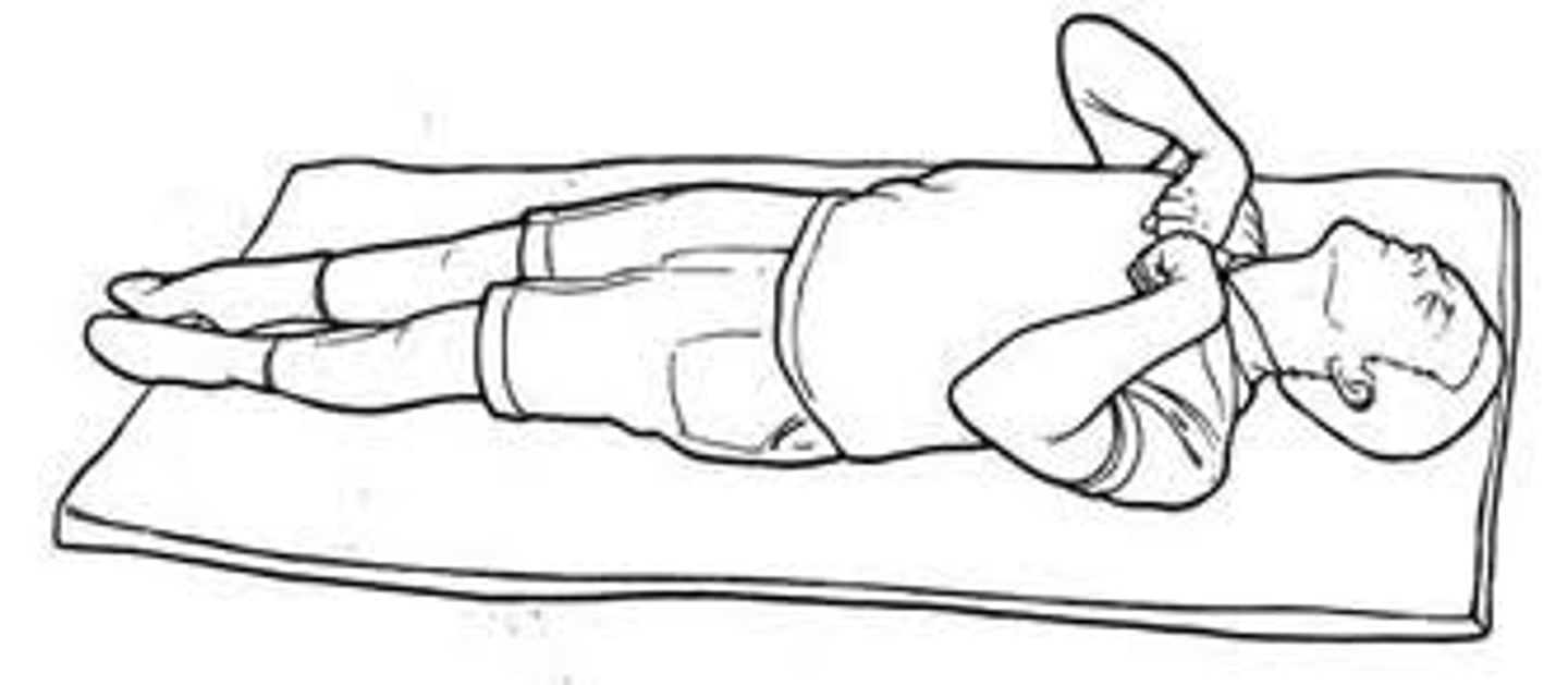 <p>o "coming to the core"</p><p>o Flexion of arms, wrists, and fingers with adduction in upper extremities. Extension, internal rotation, and plantar flexion in lower extremities</p><p>o Interruption of the voluntary motor tracts in the cerebral cortex</p>