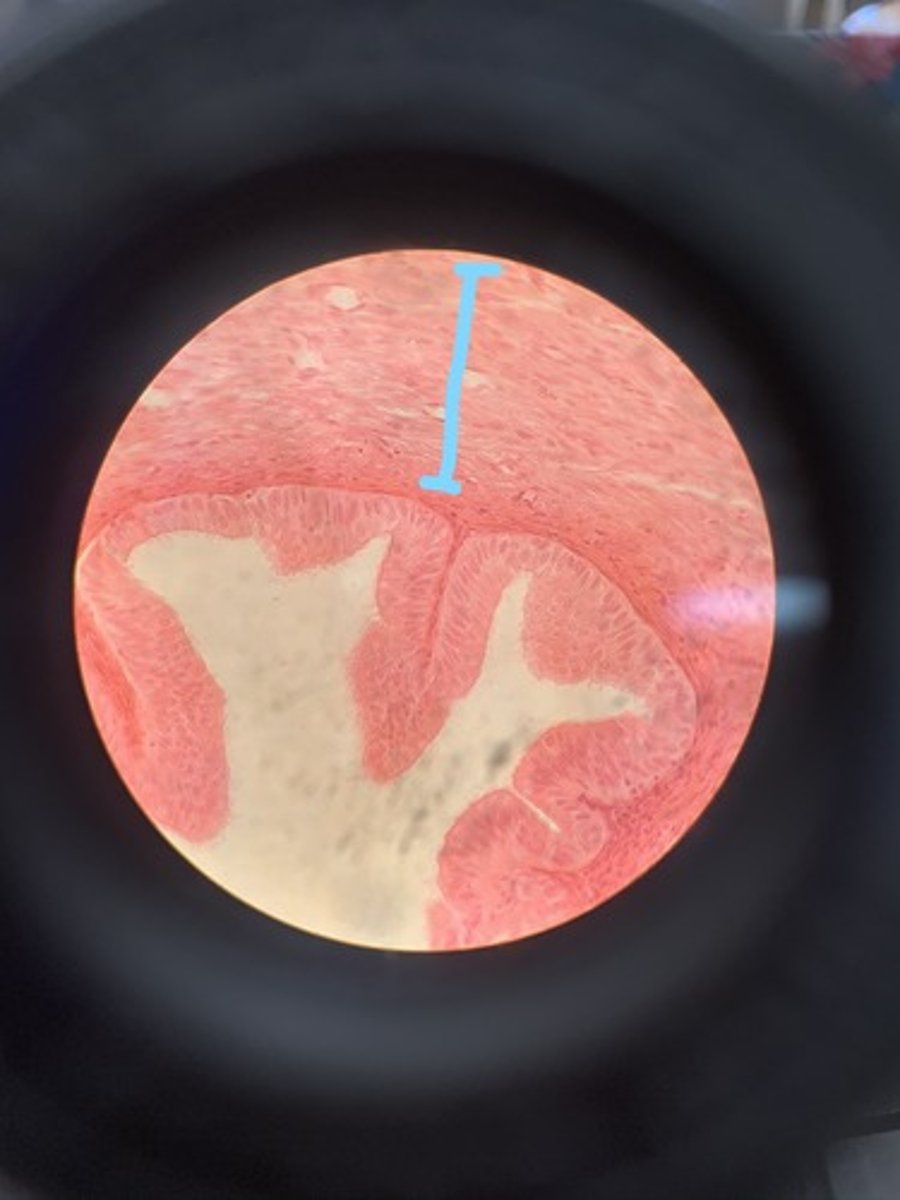 <p>in myometrium it is made of</p>