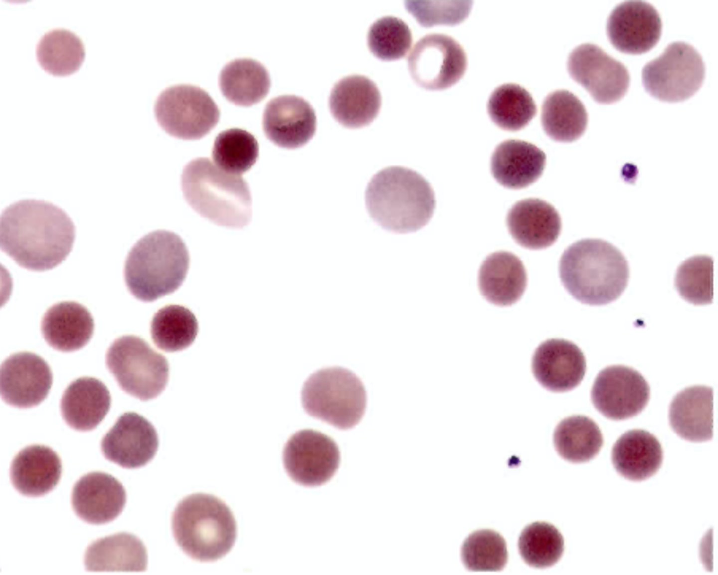 <p>C. Direct antiglobulin test</p>