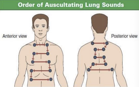 <ol><li><p>vesicular sounds</p></li></ol><p></p><p><span>Rationale: Vesicular breath sounds are normal breath sounds that are soft, low-pitched, and heard most prominently over the peripheral lung fields, especially at the lung bases. Broncho-vesicular sounds are medium-pitched with equal duration of inspiration and expiration, typically heard over the1st and 2nd interspace anteriorly and between the scapulae. Tracheal are auscultated over the trachea. Bronchial over manubrium. Vesicular breath sounds are soft, low-pitched sounds that are heard on auscultation throughout the lungs. Tracheal are auscultated over the trachea</span></p>